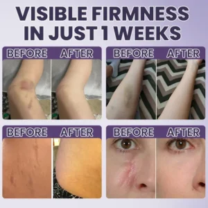 OFFICIAL
          BRAND
        

        𝑴𝑹𝑬𝑽𝑩𝑺𝑰𝑵®
      

      
        Bruise Recovery Cream · Advanced Purple Care Formula for Bruises, Bumps & Visible Discoloration