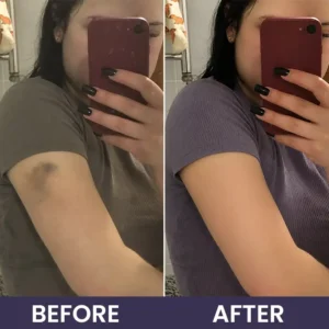 OFFICIAL
          BRAND
        

        𝑴𝑹𝑬𝑽𝑩𝑺𝑰𝑵®
      

      
        Bruise Recovery Cream · Advanced Purple Care Formula for Bruises, Bumps & Visible Discoloration