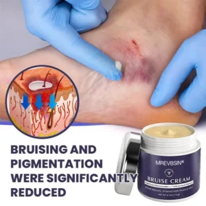 OFFICIAL
          BRAND
        

        𝑴𝑹𝑬𝑽𝑩𝑺𝑰𝑵®
      

      
        Bruise Recovery Cream · Advanced Purple Care Formula for Bruises, Bumps & Visible Discoloration