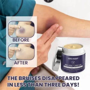 OFFICIAL
          BRAND
        

        𝑴𝑹𝑬𝑽𝑩𝑺𝑰𝑵®
      

      
        Bruise Recovery Cream · Advanced Purple Care Formula for Bruises, Bumps & Visible Discoloration