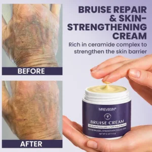 OFFICIAL
          BRAND
        

        𝑴𝑹𝑬𝑽𝑩𝑺𝑰𝑵®
      

      
        Bruise Recovery Cream · Advanced Purple Care Formula for Bruises, Bumps & Visible Discoloration