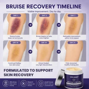 OFFICIAL
          BRAND
        

        𝑴𝑹𝑬𝑽𝑩𝑺𝑰𝑵®
      

      
        Bruise Recovery Cream · Advanced Purple Care Formula for Bruises, Bumps & Visible Discoloration